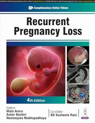 Recurrent Pregnancy Loss фото книги