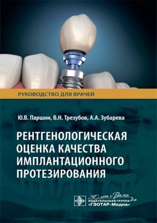 Рентгенологическая оценка качества имплантационного протезирования: руководство для врачей фото книги