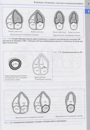 Справочник по эхокардиографии фото книги 8