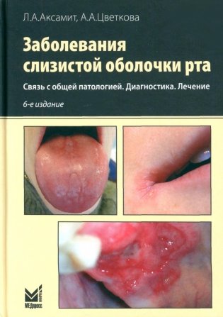 Заболевания слизистой оболочки рта. Связь с общей патологией. Диагностика. Лечение фото книги