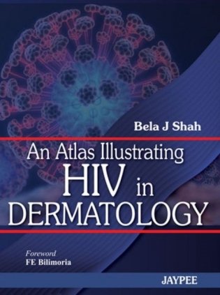 An Atlas Illustrating HIV in Dermatology фото книги