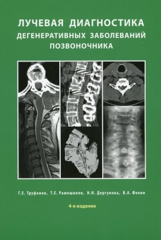 Лучевая диагностика дегенеративных заболеваний позвоночника. 4-е изд фото книги