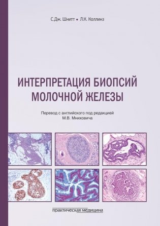 Интерпретация биопсий молочной железы фото книги