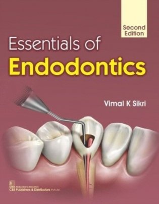 Essentials Of Endodontics 2 Ed. фото книги
