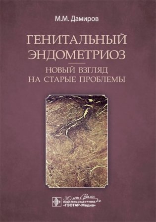 Генитальный эндометриоз. Новый взгляд на старые проблемы фото книги
