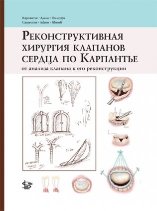 Реконструктивная хирургия клапанов сердца по Карпантье: от анализа клапана до его реконструкции фото книги