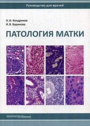 Патология матки. Руководство для врачей фото книги