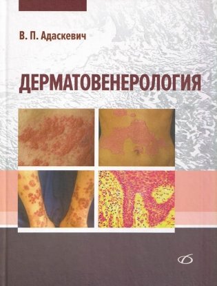 Дерматовенерология фото книги