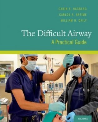 The Difficult Airway A Practical Guide фото книги