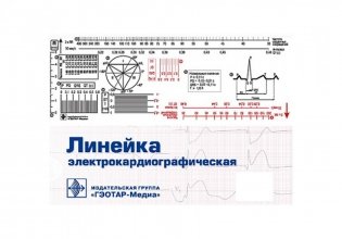 Линейка электрокардиографическая: ЭКГ-линейка для расшифровки электрокардиограммы, снятой со скоростью 50 или 25 мм/с фото книги