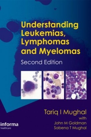 Understanding Leukemias, Lymphomas and Myelomas, Second Edition фото книги