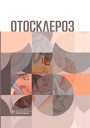 Отосклероз фото книги