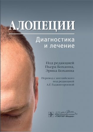 Алопеции. Диагностика и лечение фото книги