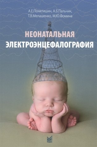 Неонатальная электроэнцефалография фото книги