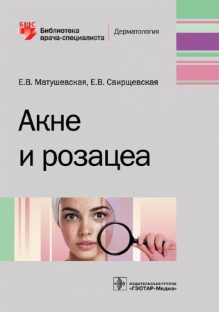 Акне и розацеа фото книги