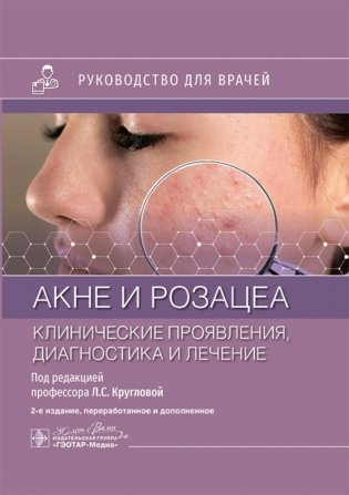 Акне и розацеа. Клинические проявления, диагностика и лечение: руководство для врачей. 2-е изд., перераб. и доп фото книги