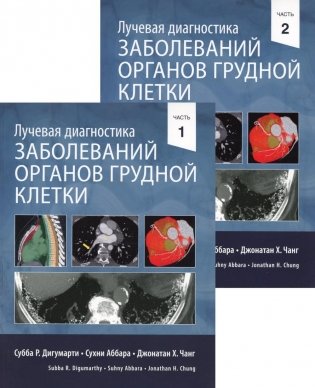 Лучевая диагностика заболеваний органов грудной клетки. В 2 ч. (комплект из 2-х книг) фото книги