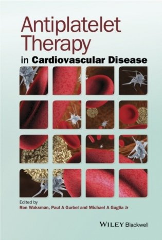 Antiplatelet Therapy фото книги
