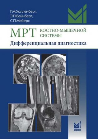 МРТ костно-мышечной системы. Дифференциальная диагностика фото книги