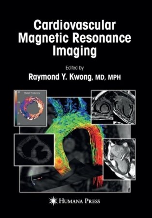 Cardiovascular Magnetic Resonance Imaging фото книги
