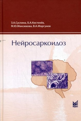 Нейросаркоидоз фото книги