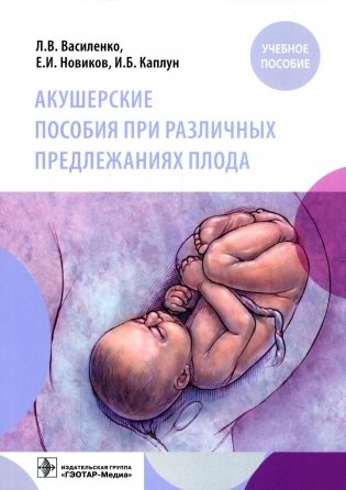Акушерские пособия при различных предлежаниях плода: Учебное пособие фото книги