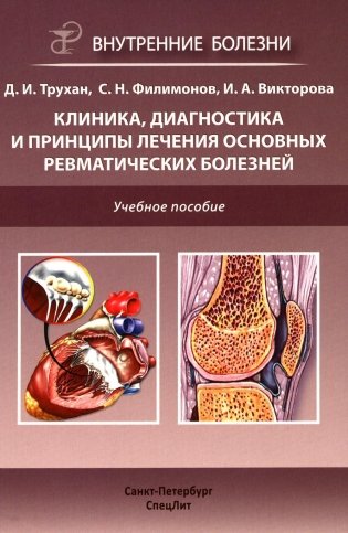 Клиника, диагностика и лечение основных ревматических болезней. Учебное пособие фото книги