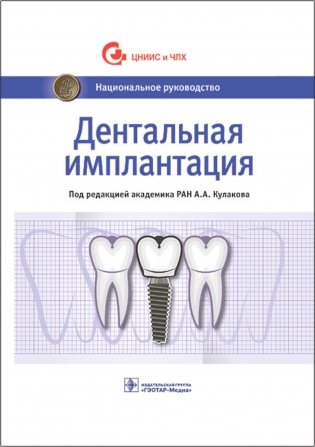 Дентальная имплантация: национальное руководство фото книги