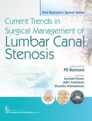 Current Trends In Surgical Management Of Lumbar Canal Stenosis (Pb 2019) фото книги