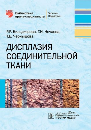 Дисплазия соединительной ткани фото книги