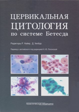 Цервикальная цитология по системе Бетесда фото книги
