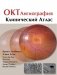 ОКТ-ангиография. Клинический атлас фото книги маленькое 2