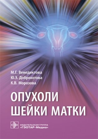 Опухоли шейки матки фото книги