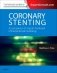 Coronary Stenting: A Companion to Topol's Textbook of Interventional Cardiology фото книги маленькое 2