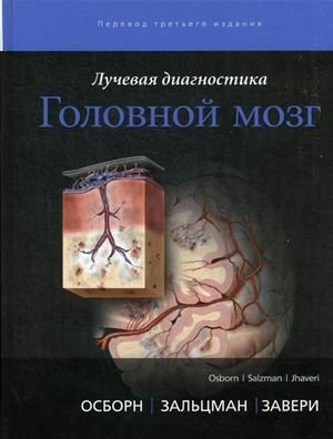 Лучевая диагностика. Головной мозг фото книги