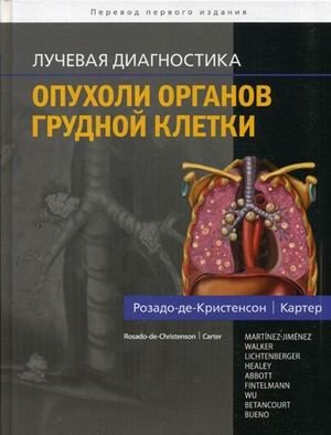 Лучевая диагностика. Опухоли органов грудной клетки фото книги