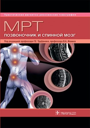МРТ. Позвоночник и спинной мозг: руководство для врачей фото книги