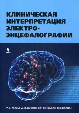 Клиническая интерпретация электроэнцефалографии фото книги